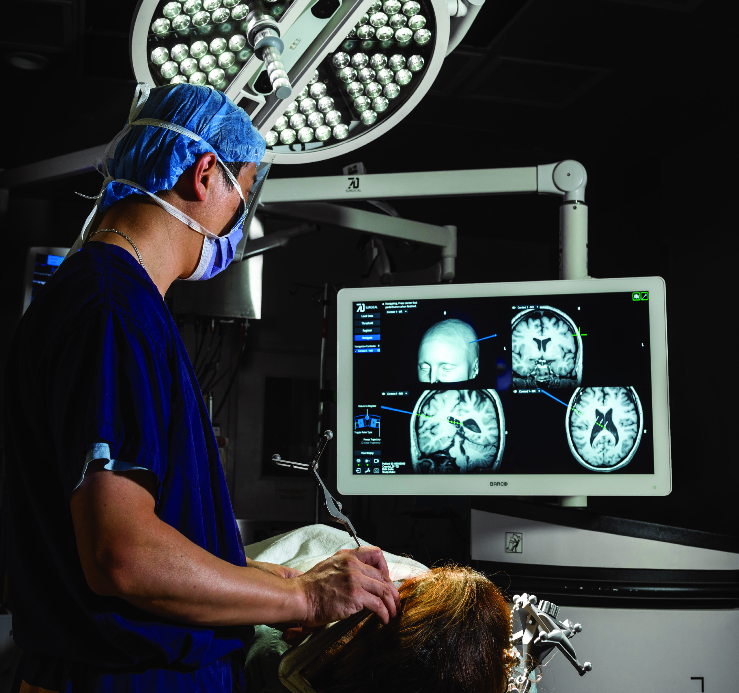 The Cranial module of the FLASH™ Navigation System in intraoperative use, navigating on CT/MRI imaging (7D Surgical/Orthofix material)
