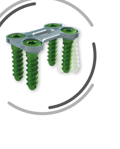 TOSCA® — ultra-thin pre-lordosed plate (1.6 mm) with color-coded self-tapping screws (official SIGNUS render)
