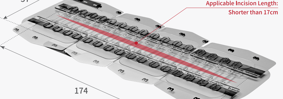 Xkin Foldable Skin Closure — dispozitivul (model FS2017, 174 × 57 mm), pentru incizii de până la 17 cm (material Surginus)
